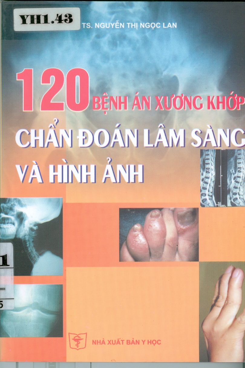 120 bệnh án xương khớp chẩn đoán lâm sàng và hình ảnh